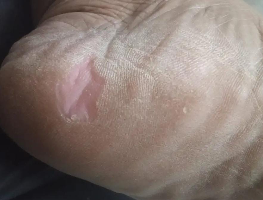 चूहों के आतंक पर मचा सियासी बवाल – मेडिकल अस्पताल प्रबंधन घिरा सवालों में 2 1758012121 WhatsApp Image 2025 09 16 at 1.30.55 PM